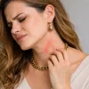 تشخیص مروارید اصل از تقلبی؛ راهنمای جامع خانگی و آزمایشگاهی درمان حساسیت به بدلیجات